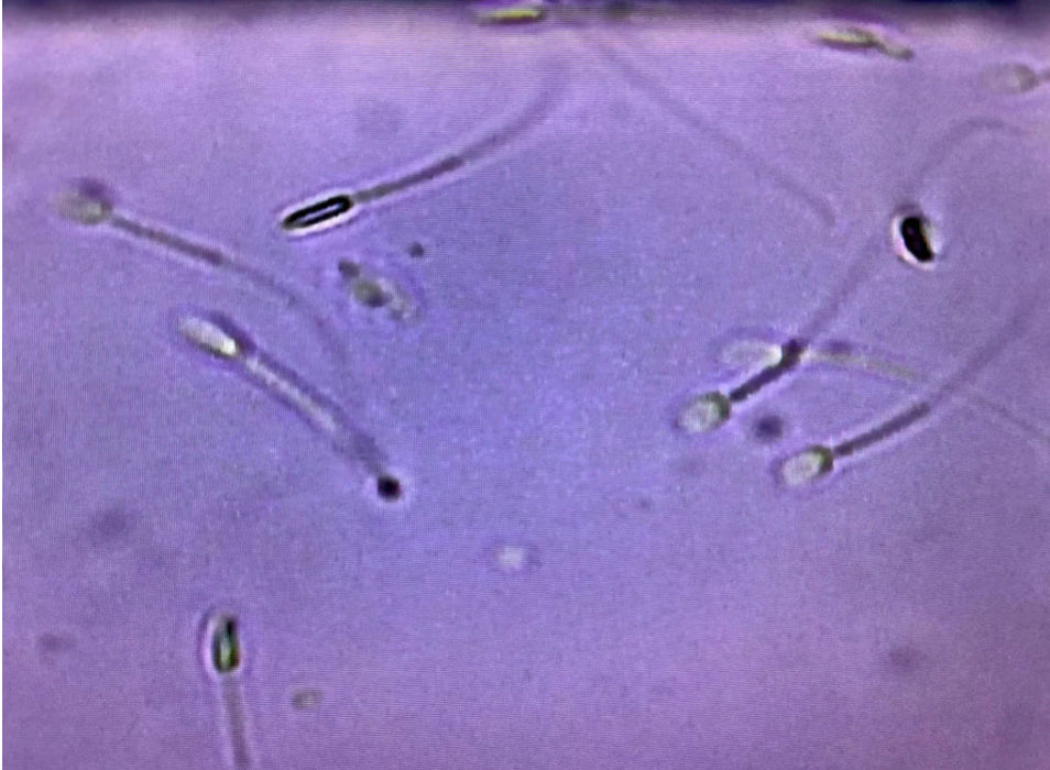 SPERM COUNTING CHAMBER DRM-600 (50CT) CELL-VU DISPOSABLE