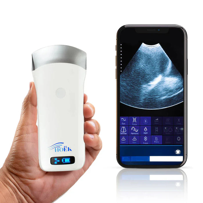 Traveler Lite 250 Wireless Ultrasound Scanner